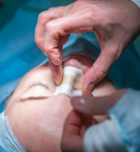 ניתוח אף שניוני - תמונת אווירה